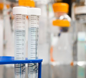 Roadside drug driver testing